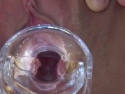 【無】マンコ図鑑 ～これがカリビの醍醐味だ！2017蔵出しマンコ～ パート2 11/16