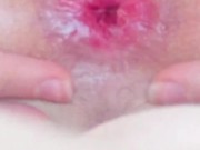 Anal masturbation compilation  16/16