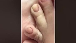 @tici_feet IG tici feet tici_feet taking off polish toenail