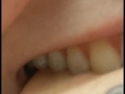 Biting Part 2
