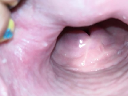 Cervix close up [4k]