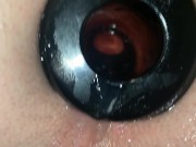 Fucking My Boyfriends Piss Filled Ass and Making Him Cum 2/16