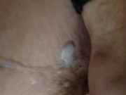 dredhe of the head of the penis 11/16