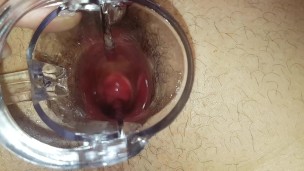 Trying To Look In My Hole - Speculum