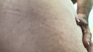 Upclose Birthmark On Ass Show off