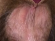 Shows Her Mega Hairy Pussy & Giggles