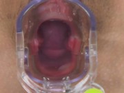 【無】マンコ図鑑 日高千晶 パート1 16/16