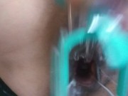 Masturbating with a speculum 13/16
