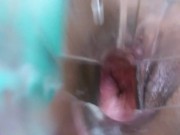 Masturbating with a speculum 15/16