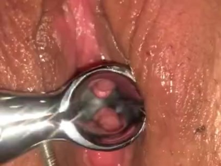 Milf first time speculum, with cum in pussy