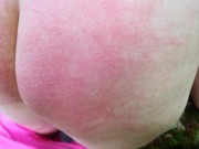 Nettle play outdoor - burning ass
