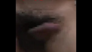 Penis(Mosaic)
