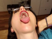 Mouth Tour After Gum Graft. Periodontic Work 10/16