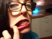 Mouth Tour After Gum Graft. Periodontic Work 6/16