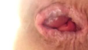 Gaping fist hole