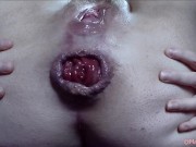 Watch me play with my huge anal rosebud