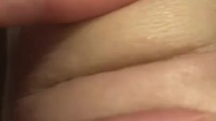 Knee vagina 