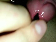 УРЕТРАЛЬНЫЙ ДРОЧ Uretral jerking 4/16