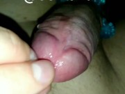 УРЕТРАЛЬНЫЙ ДРОЧ Uretral jerking 9/16