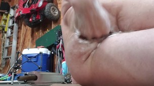 Hard anal fisting and prolapse