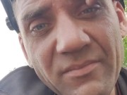 Granulation site. 10/16