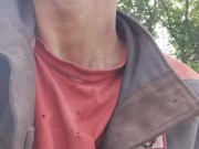 Granulation site. 15/16