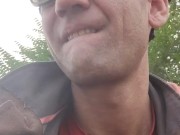 Granulation site. 4/16