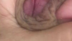 Close-Up Jacking My Restored Foreskin 
