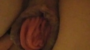 Prolapse play closeup