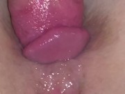 Please Cum in my Ass!!!  Extreme Close up Anal  -Amateur Homemade- 10/16