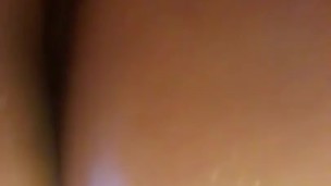 CULO ACEITOSO
