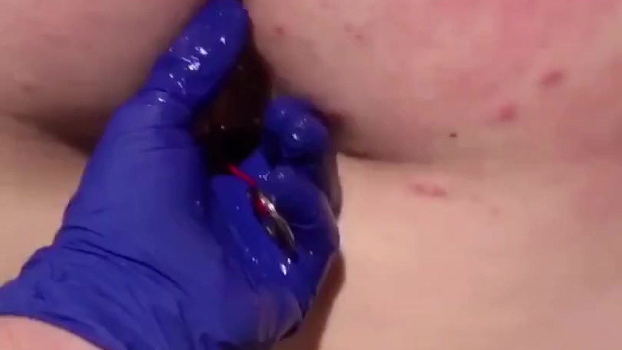 Bdsm anal bead - RedTube