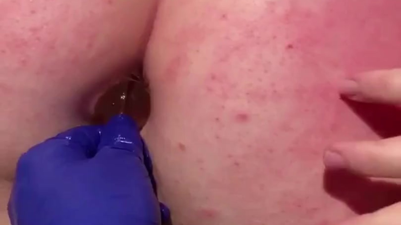 Bdsm anal bead - RedTube