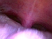 Stepson Stepped On or Sallowed: Version #2 PREVIEW 11/16