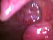 Stepson Stepped On or Sallowed: Version #2 PREVIEW 12/16