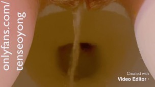 Pissing Complication 
