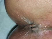 HOT MEXICAN 19 YEARS OLD ANAL DESTROYED DESTRUCTION GAPE CLOSE-UP!!
