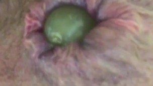 Raisin dans le cul