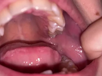 Dental examination. Teeth tour