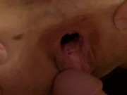Gaped Pussy Slut Fucked!!! 13/16