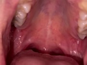 Candy gagging. Xmas underwear. Uvula show 1/16