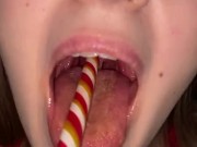 Candy gagging. Xmas underwear. Uvula show 13/16