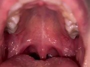 Candy gagging. Xmas underwear. Uvula show 14/16