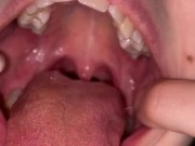 Candy gagging. Xmas underwear. Uvula show 7/16