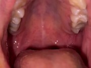 Candy gagging. Xmas underwear. Uvula show 9/16