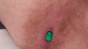 Balloon anal insertion