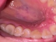 Mouth tour. Uvula and teeth