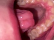 Mouth tour. Uvula and teeth  10/16