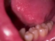 Mouth tour. Uvula and teeth  12/16