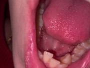 Mouth tour. Uvula and teeth  14/16